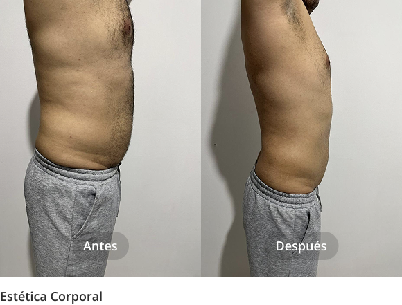 estetica_corporal_1