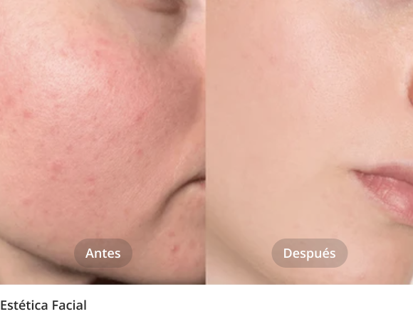 estetica_facial